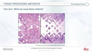 Lessons From the Laboratory Optimizing Your Tissue Processing [upl. by Suirrad145]