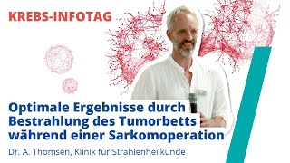 Optimale Ergebnisse durch Bestrahlung des Tumorbetts während einer Sarkomoperation [upl. by Yniattirb]