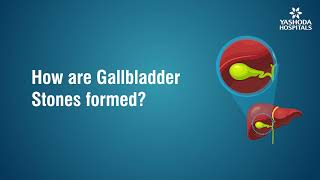 How are Gallbladder Stones formed [upl. by Jori]