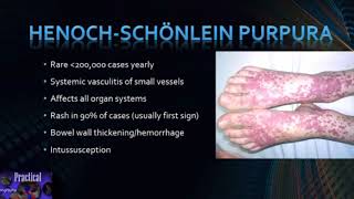 HenochSchönlein Purpura [upl. by Enal]