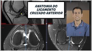 Anatomia do Ligamento Cruzado Anterior [upl. by Adlin]