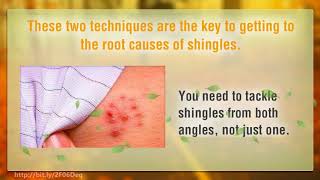 Get Rid of Shingles  A 3 Step Alternative Pain Treatment Relief Method and Recommendation Guide [upl. by Perren]