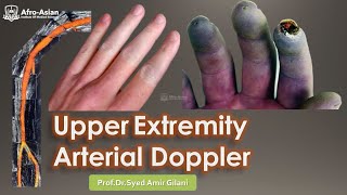 Upper Limb Arterial Doppler  afroasianims [upl. by Shih]