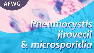 Latest on P jirovecii microsporidia – Prof D Marriott [upl. by Suki]