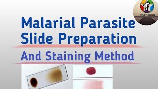 Malarial Parasite Slide Preparation And staining Method [upl. by Clari]