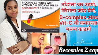 Becosules Z capsule l B complex zinc Vitamin C l Becosules Z cap l Rohini pharmacist l [upl. by Feetal]