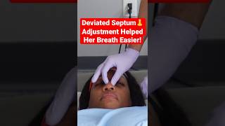 Deviated Septum 👃 Adjustment Helped Her Breath Easier shorts [upl. by Suoicul]