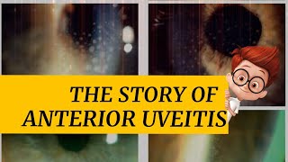 The story of ANTERIOR UVEITIS  iritis cyclitis and iridocyclitis  Signs amp symptoms and more [upl. by Hansen]