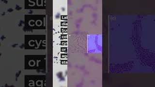 Lets Review Corynebacterium Diphtheriae shorts 😷🤔 [upl. by Bellew]