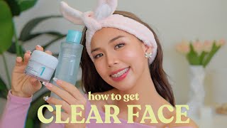 THE BEST SUMMER SKINCARE FOR OILY ACNEPRONE SKIN easy amp effective 💕😳 [upl. by Yrelav]