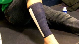 Shin Splint Taping [upl. by Peh]