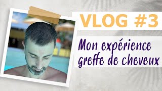 Mon expérience greffe de cheveux  Vlog 3 [upl. by Reg642]