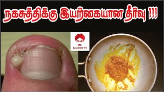 Nailfungus நகசுத்திக்கு இயற்கையான தீர்வு  Get Rid of nails fungus in tamil  Natural Treatment [upl. by Huei521]