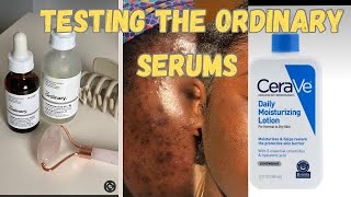 TRYING THE ORDINARY SERUMS ON ACNE PRONE SKIN SKIN CARE NIACINAMIDE [upl. by Lundberg]