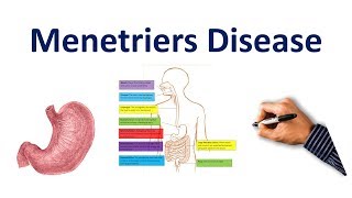 Menetriers Disease Made Easy USMLE Step 1 NCLEX COMLEX [upl. by Cryan]