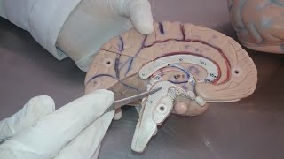 Diencephalon small model  Practical anatomy 2nd year [upl. by Sev]