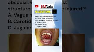 Draining Peritonsillar Abscess medical doctor nursing [upl. by Kelam]