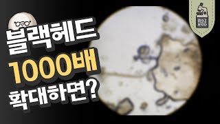 블랙헤드를 제거하자 블랙헤드 1000배 현미경으로 보았다 미나니의 스낵교양 [upl. by Aiuqcaj]