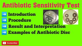 antibiotic sensitivity test  antimicrobial susceptibility test procedure  Kirby Bauer method [upl. by Dulciana]