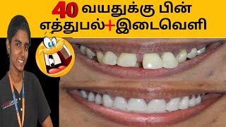 ஈறு பிரச்சனையால் முன் பல் தூக்கல் இடைவெளி தீர்வு என்ன Front teeth gap and gum problems solution [upl. by Jehiah873]