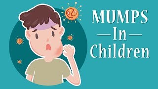 Mumps in Children  Signs Causes amp Treatment [upl. by Loesceke]