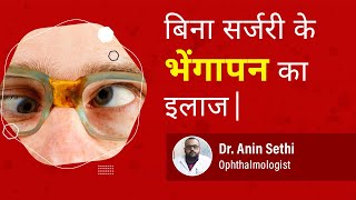 Squint Eye आँखों का भेंगापन Can Squint Eye can be treated without surgery  Dr Anin Sethi [upl. by Pavia]