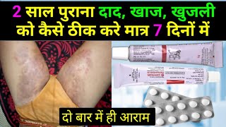 2 साल पुराने दाद खाज खुजली को कैसे ठीक करें  fungal infection in private parts  khujli ki dawa [upl. by Dyrrej]