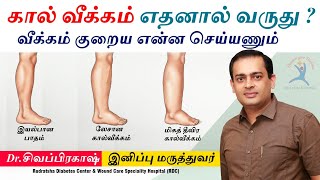 கால் வீக்கம் எதனால் வருகிறது கால் வீக்கம் குறைய என்ன செய்யணும்  Dr Sivaprakash [upl. by Eded]