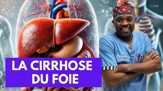 Tout ce que vous devez savoir sur La cirrhose du foie par docteursourire [upl. by Bartholomeus]