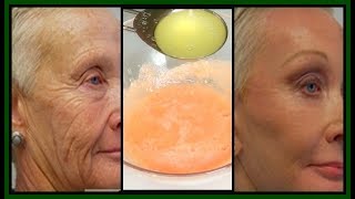 LOOK 5  10 YEARS YOUNGER  ANTI  AGING TOMATO LEMON FACIAL MASK Khichi Beauty [upl. by Cleti]