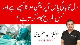 How Does Heart Bypass Work Coronary Artery Bypass Graft Procedure  Dr Saeed Afridi [upl. by Graehl]