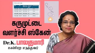 Follicular study  கரு முட்டை வளர்ச்சி ஸ்கேன் [upl. by Melleta]