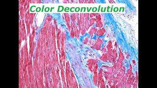 Separating colors in light microscopy images Color Deconvolution in ImageJFIJI [upl. by Donovan411]