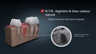 RTR Biomatériau résorbable pour la régénération osseuse [upl. by Marita285]