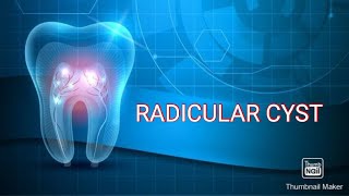 RADICULAR CYST [upl. by Durr]