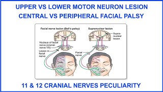 UPPER VS LOWER MOTOR NEURON LESIONCENTRAL VS PERIPHERAL FACIAL PALSY11amp12CRANIAL NERVE PECULIARITY [upl. by Downs]