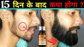 Ustraa Beard Growth Oil Review in Hindi 2024  Best Beard Oil For Extreme Growth  How to Grow Beard [upl. by Essilevi]