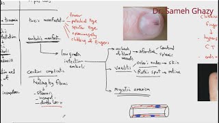 Systemic pathology 4  CVS infective and noninfective endocarditis DRSAMEH GHAZY [upl. by Gish]