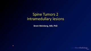 Spine tumors 2 – Intramedullary lesions [upl. by Solim]