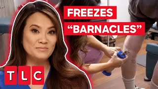 Dr Lee FREEZES “Barnacles” Off Man’s Skin  Dr Pimple Popper This Is Zit [upl. by Bartholemy920]