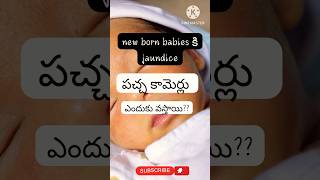 How jaundice occurs in newbornsbabycare healthcareyoutube youtubeshorts viralvideo [upl. by Bethina]