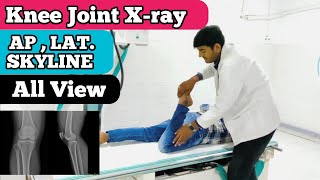 knee joint xray position  AP Lat Skyline view  Skyline view Xray Position [upl. by Soph723]