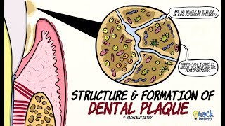 Dental Plaque Structure and Formation [upl. by Asena509]