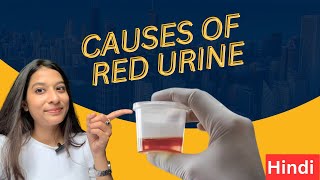 Causes of Red Urine  What is Hematuria by Dr Prachi Mahajan [upl. by Sille975]