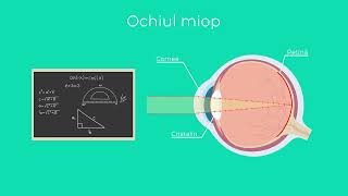 Animatie 2D  lentile de contact [upl. by Aurore]