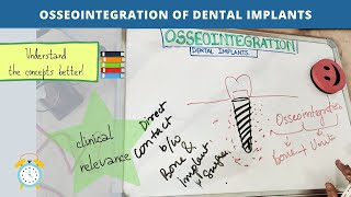 osseointegration of dental implants Part  1 [upl. by Litman69]