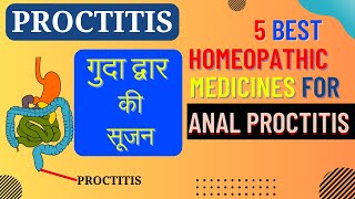 Proctitis Symptoms and Treatment  Top 5 Homeopathy Medicine for Proctitis [upl. by Akirrehs680]