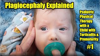 1 Plagiocephaly Explained Pediatric Physical Therapy with a Child with Torticollis amp Prematurity [upl. by Oigufer]