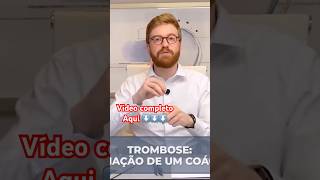 TROMBOSE nas Veias trombose [upl. by Tarrsus]