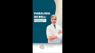 Entenda melhor sobre a Paralisia de Bell [upl. by Neelyaj]